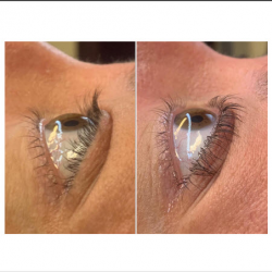 Lash Lift