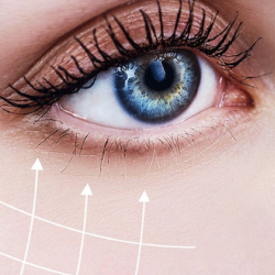 Eyelid Surgery