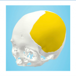 Neurological Imaging and Diagnostics