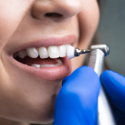 Dental Cleanings and Hygiene