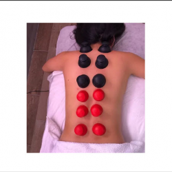​Cupping