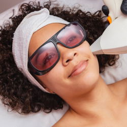 Laser Hair Removal