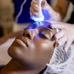 Microneedling