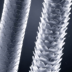 Hair Realignment System