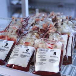 Patient Blood Management