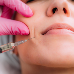 Dermal Filler