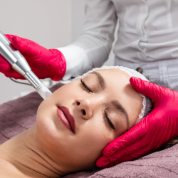 Microneedling and Channeling