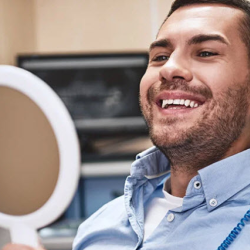 Dental Crowns