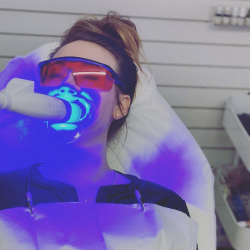 Teeth Whitening