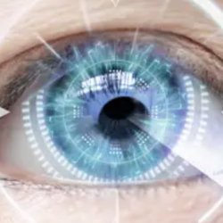 LASIK