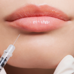 Dermal Filler