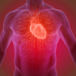Aorta Disease and Marfan