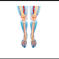 Venous Disease/Deep Vein Thrombosis