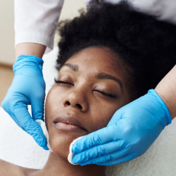 Acne Treatment