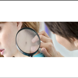Dermatology