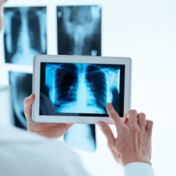Digital X-rays