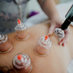 Cupping Therapy