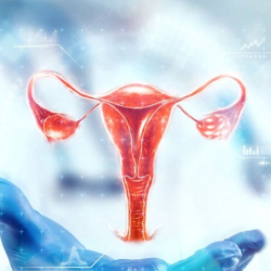 Uterine Fibroids and Endometriosis Contraception