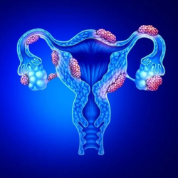 Endometriosis Related Pain – (ERP)