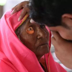Cataract Evaluation and Management