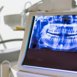 Advanced Dental X-Rays