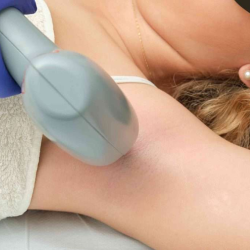 Laser Hair Removal – Permanent Hair Removal