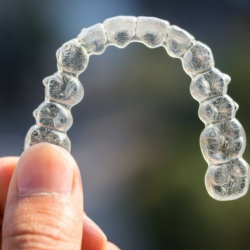 Invisalign Clear Brace