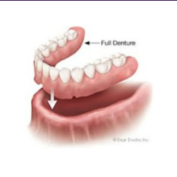 Removable Prosthetics