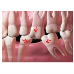 Simple Surgical Procedures