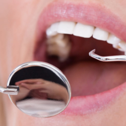 Dental Cleaning & Exams