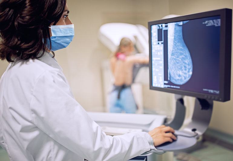 Mammography