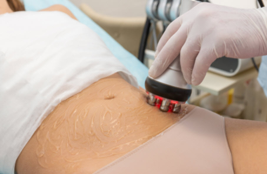 6 Skin Tightening Laser Lifo + RF