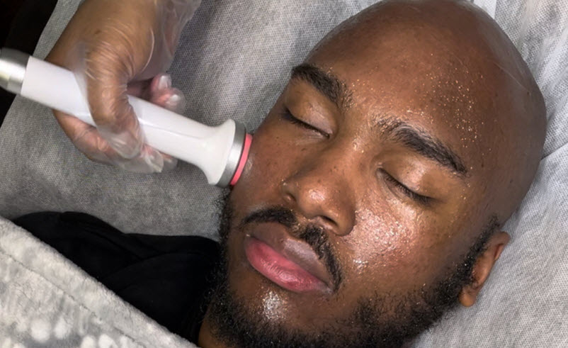 Radio Frequency Facial