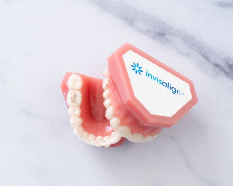 Invisalign