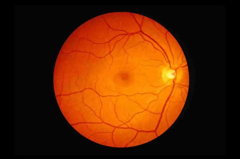  Retinal Imaging