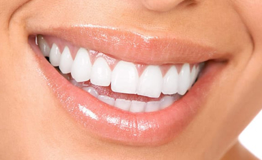 Teeth Whitening