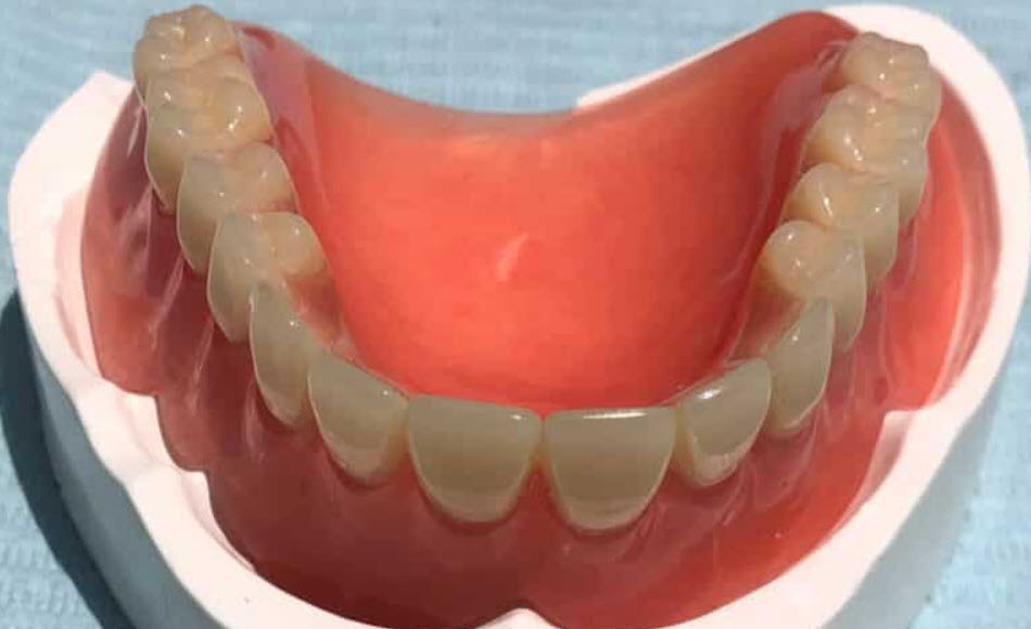 Dentures and Partial Dentures