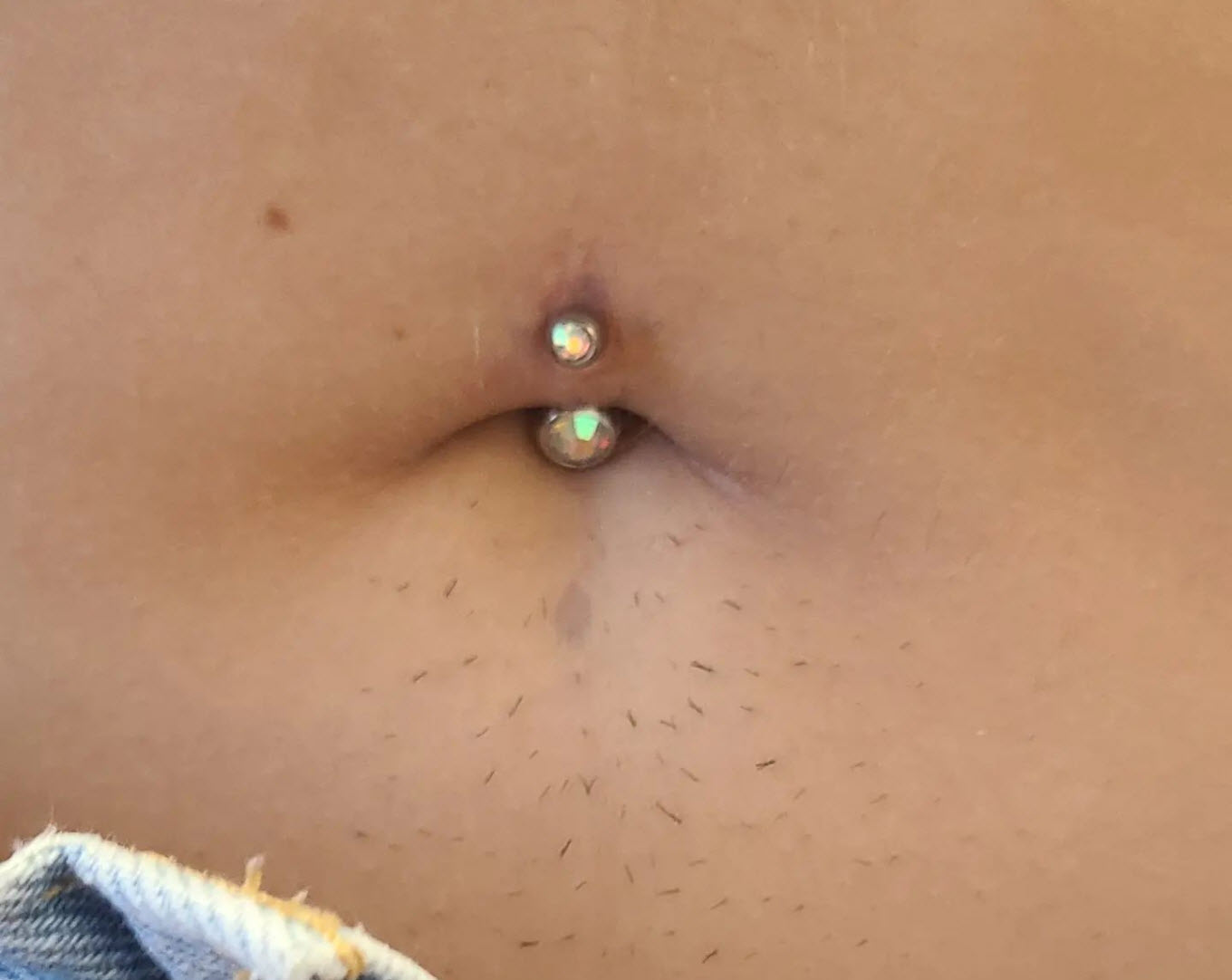 Navel