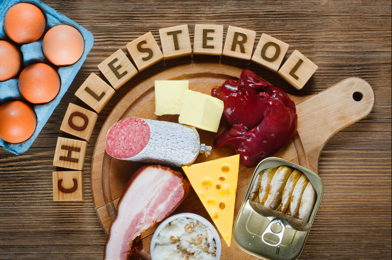 High Cholesterol Management Program