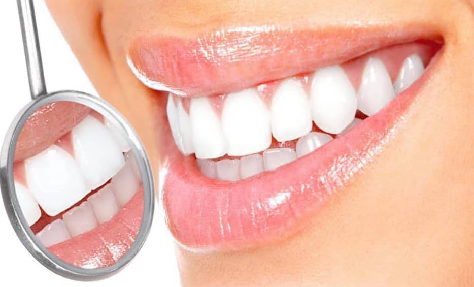 Teeth-Whitening 