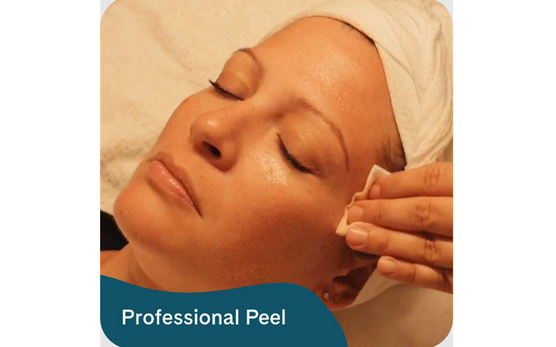 Professional Peel