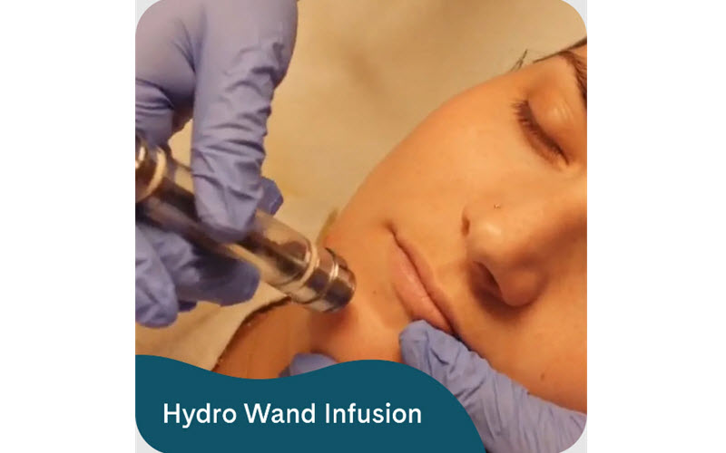 Hydro Wand Infusion