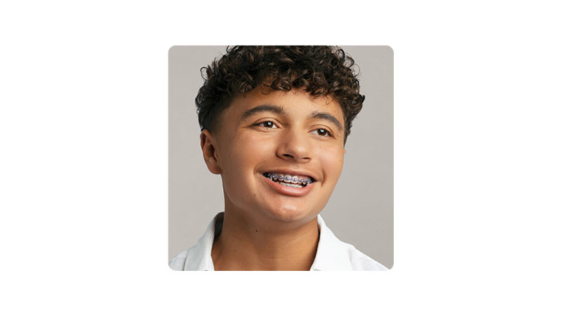 Metal Braces