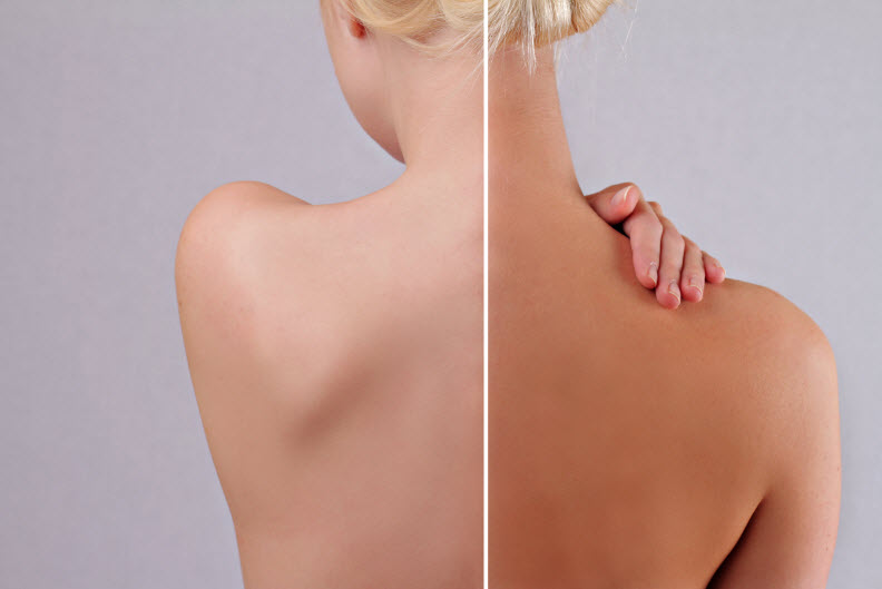 Spray Tan
