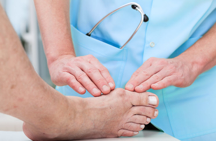 Bunion Treatment