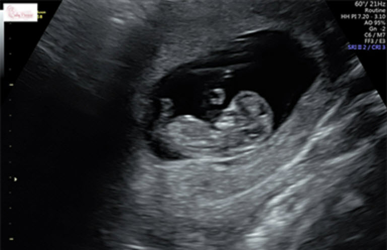 First Peek