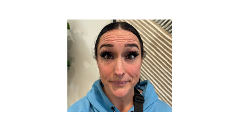 Chin Filler near Lehi Utah
