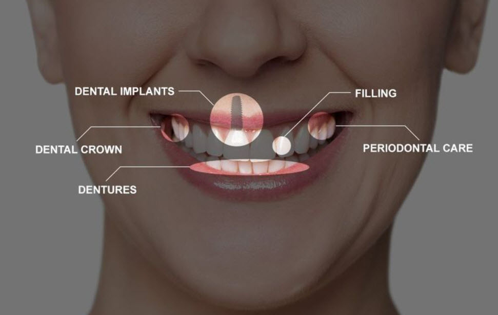 Restorative Dentistry