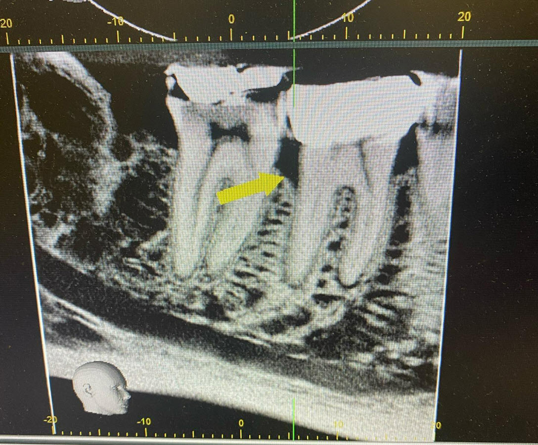 CBCT 3-D Imaging