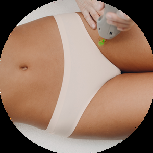 Laser Hair Removal